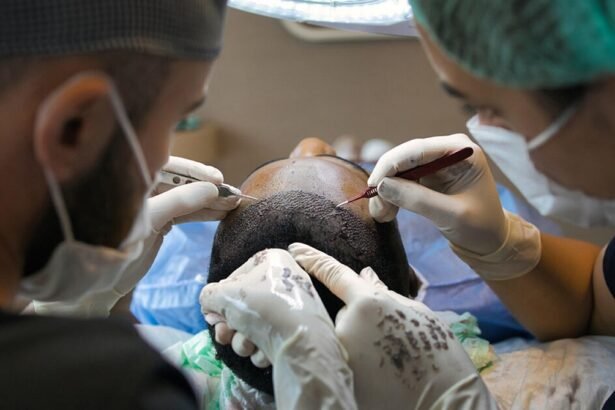 Haarpigmentierung vs. Haartransplantation